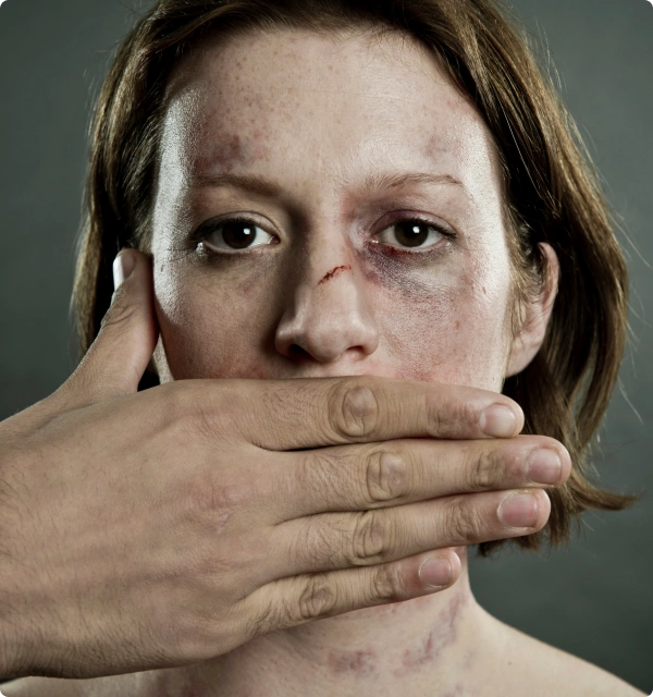 Mujer con el rostro golpeado y una mano cubriéndole la boca
