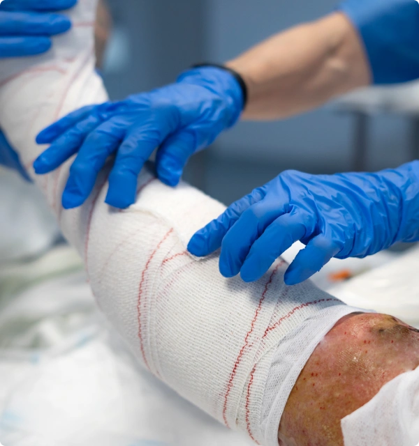 Manos con guantes azules vendando una pierna lesionada